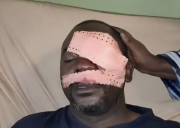 Agression violente du journaliste Daouda Bah de la RTG par des jeunes au quartier Bomboly