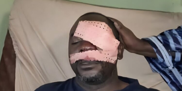 Agression violente du journaliste Daouda Bah de la RTG par des jeunes au quartier Bomboly